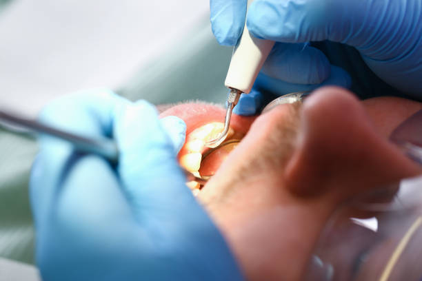 Best Same-Day Emergency Dentist in Corbin, KY