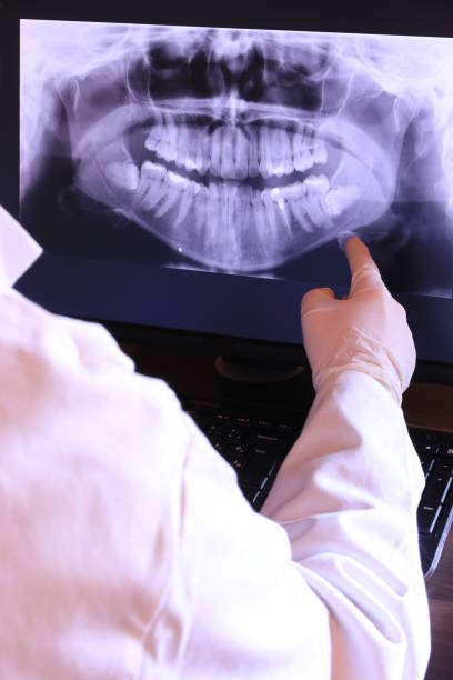 Best Emergency Broken Tooth Repair in Corbin, KY